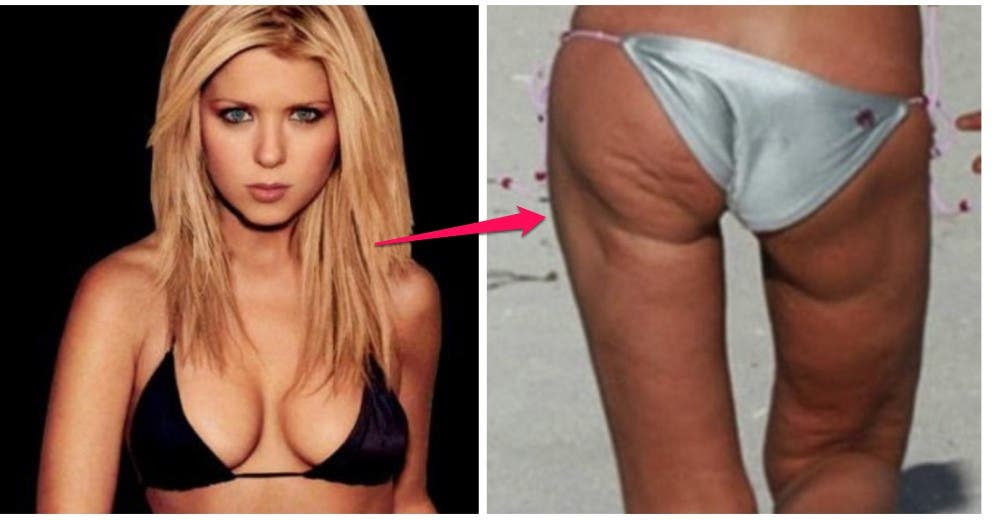 Después de ver las fotos de famosas sin editar, tu autoestima llegará al cielo Después de ver las fotos de famosas sin editar, tu autoestima llegará al cielo