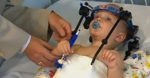 Este bebé volvió a nacer: su cabeza se desprendió en un accidente, pero pudieron salvarlo