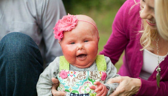 mensaje-de-madre-de-una-bebe-que-se-ve-diferente2