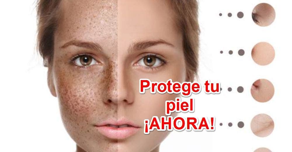 Protege tu piel contra quemaduras y manchas solares con 12 consejos