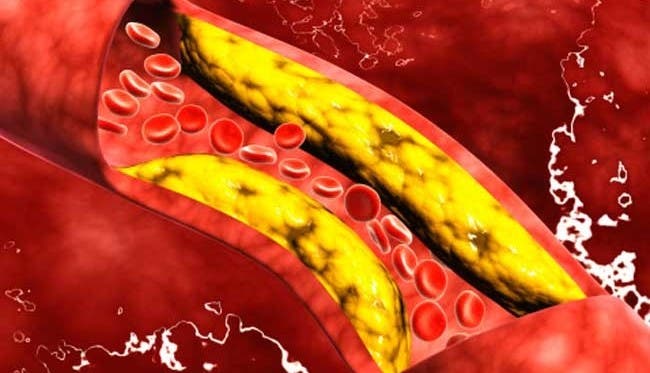 15-alimentos-para-limpiar-las-arterias10