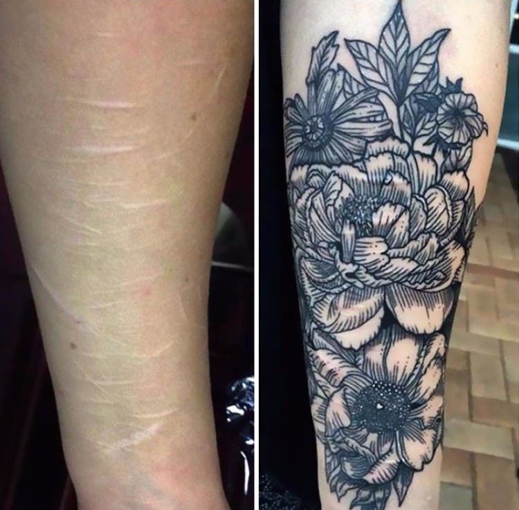 tatuajes-cubre-cicatriz-06