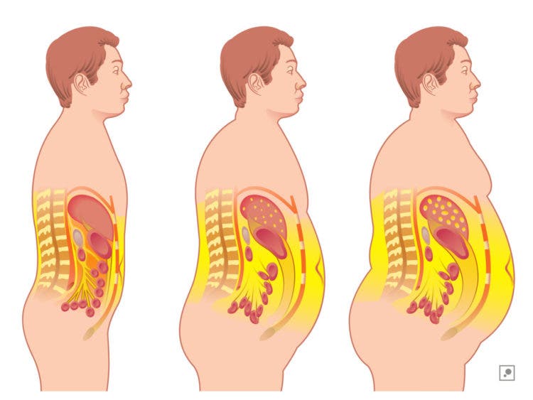 grasa-acumulada-en-el-cuerpo