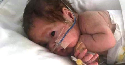 El drama del bebé prematuro que se quedó «atrapado» en otro país