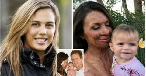 Turia Pitt, la modelo que sobrevivió a terribles quemaduras, por fin ha encontrado la felicidad