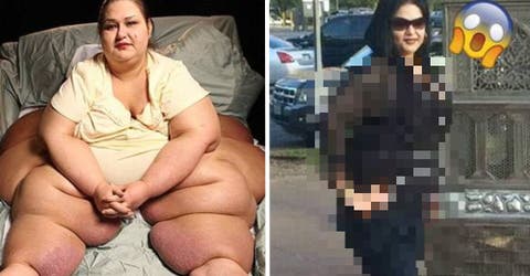 La mujer que pesaba 500 kilos y aplastó a su sobrino realiza un cambio radical