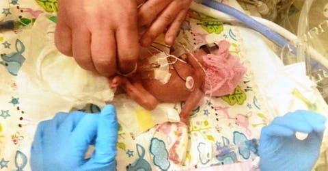 Si hubiera nacido 2 días antes los médicos no lucharían por salvar su vida