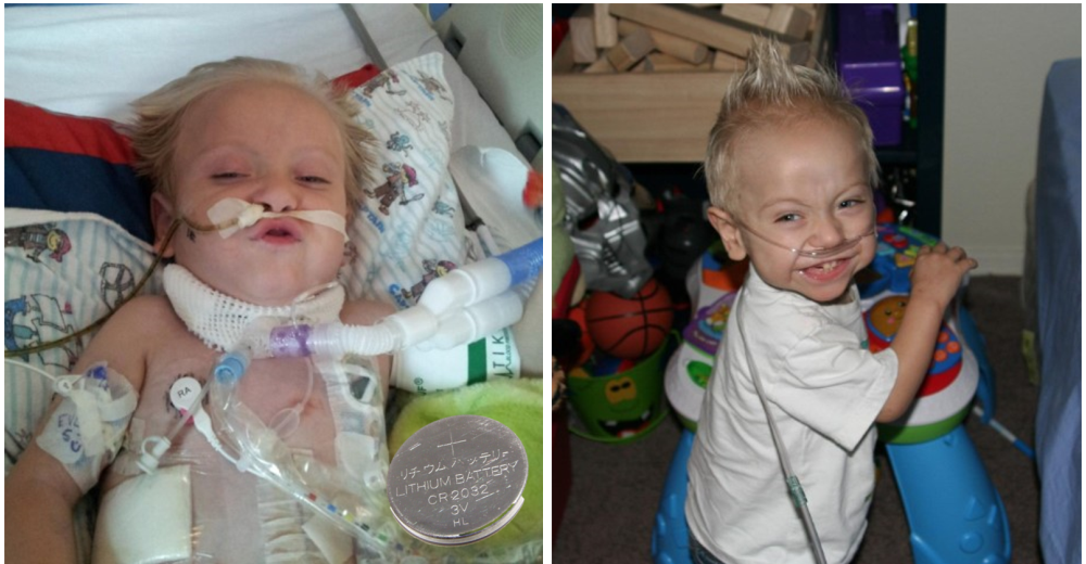 Su bebé casi muere por culpa de una batería de litio ¡Su historia puede salvar a otros! Su bebé casi muere por culpa de una batería de litio ¡Su historia puede salvar a otros!