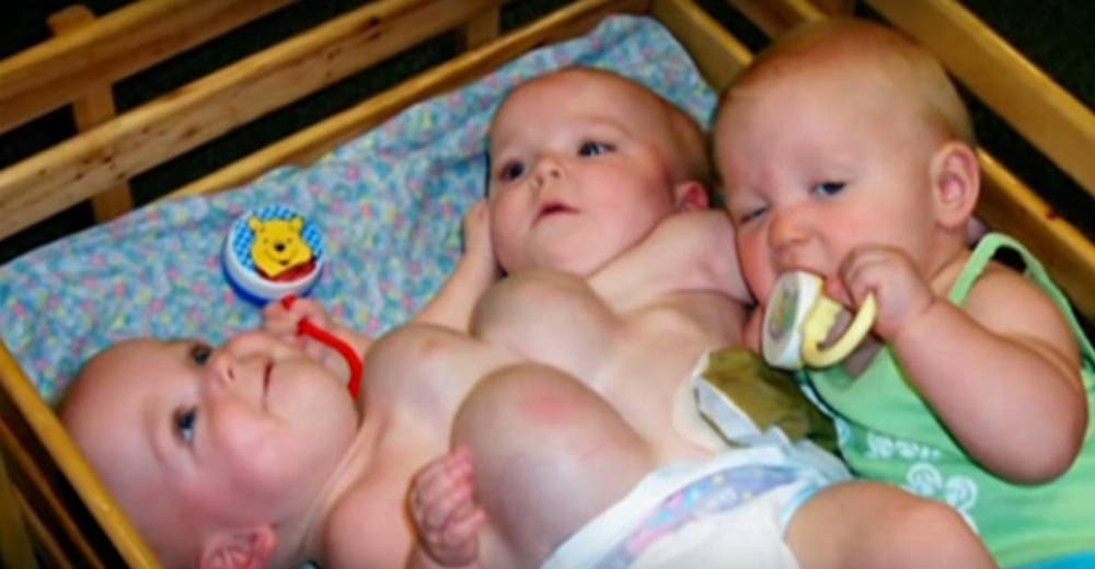 Revelan las fotos de dos de las trillizas siamesas que sobrevivieron a lo peor hace 14 años Revelan las fotos de dos de las trillizas siamesas que sobrevivieron a lo peor hace 14 años