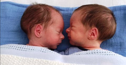 Operan a unos gemelos a sus 22 semanas de gestación y su caso causa conmoción