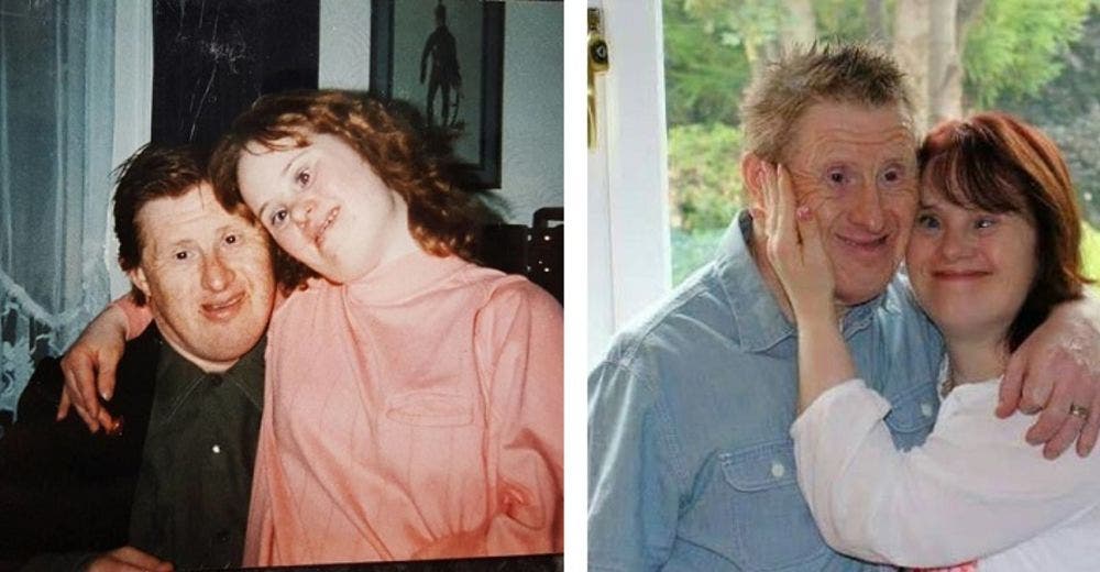 Una pareja con Síndrome de Down desafía al mundo y ahora celebran 22 años juntos