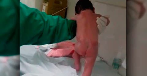 A pocos minutos de nacer este bebe «da sus primeros pasos» y deja a los médicos perplejos