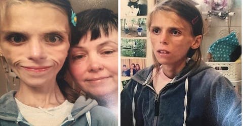 «Lo intenté pero la anorexia me ganó», escribió Pippa, de 15 años, antes de quitarse la vida
