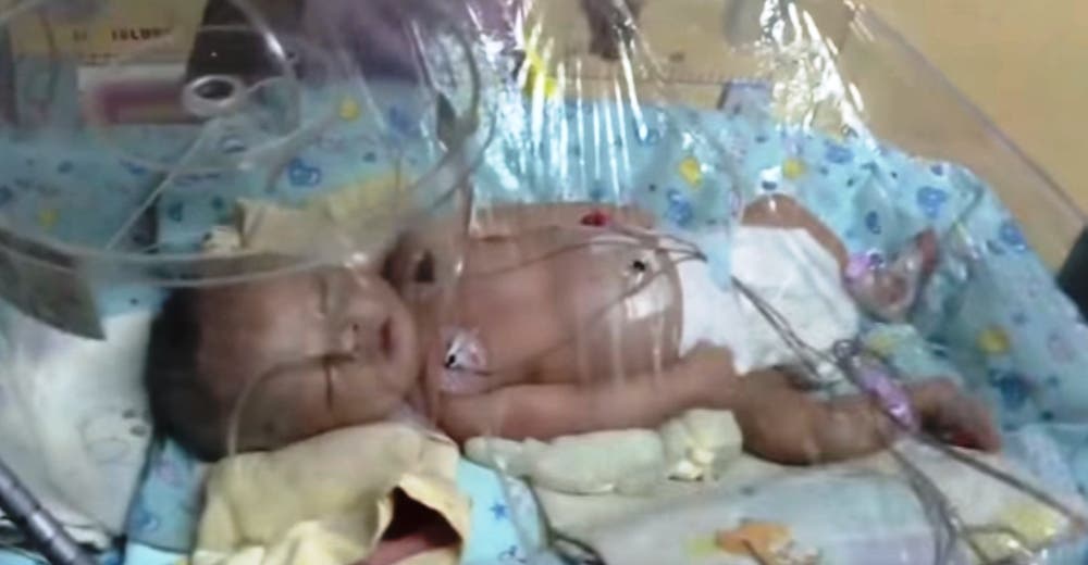 A este pobre bebé un desalmado lo enterró vivo, y un perro lo encontró para salvarle la vida A este pobre bebé un desalmado lo enterró vivo, y un perro lo encontró para salvarle la vida