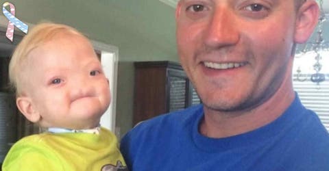 Fallece Eli Thompson, el bebé de 2 años que nació sin nariz y llegó a muchos corazones