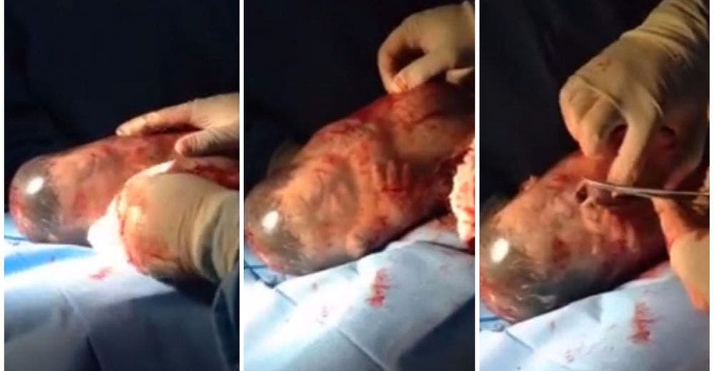 La extraordinaria forma en la que este bebé llegó al mundo dejó a todos sin palabras La extraordinaria forma en la que este bebé llegó al mundo dejó a todos sin palabras