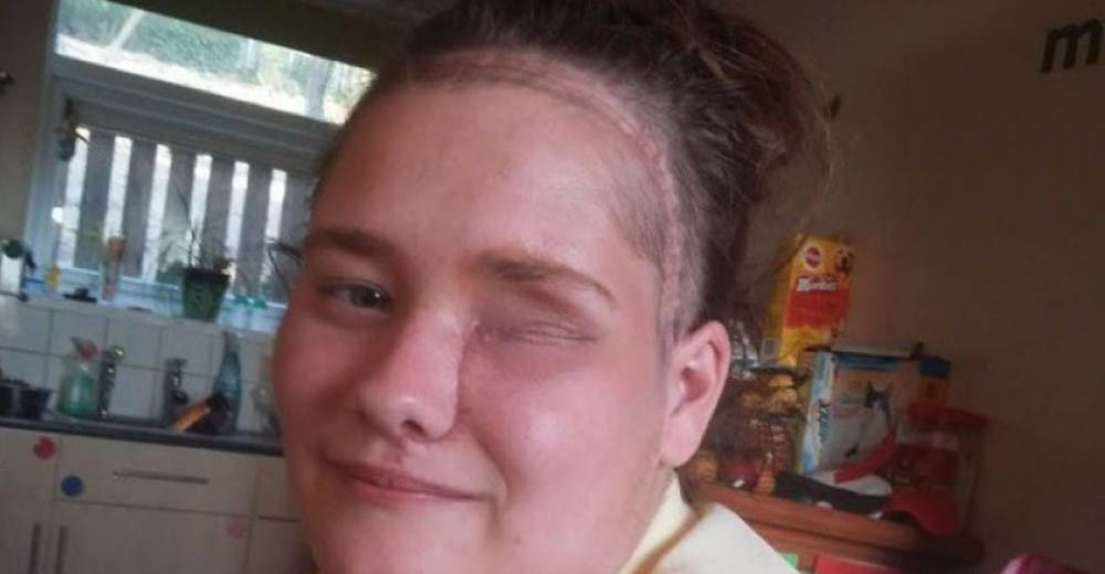 Acudió al dentista por una “infección” y terminaron extirpándole un ojo Acudió al dentista por una “infección” y terminaron extirpándole un ojo