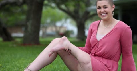 La inspiradora historia de Jillian, una joven que perdió una pierna pero no sus ganas de soñar