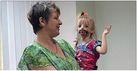 Darina, una niña de 3 años rechazada por su familia porque nació con una extraña condición