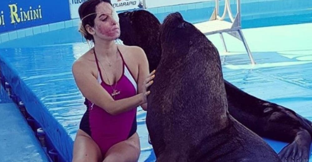 Así se recupera la modelo italiana Gessica Notaro tras el brutal ataque con ácido de su ex Así se recupera la modelo italiana Gessica Notaro tras el brutal ataque con ácido de su ex