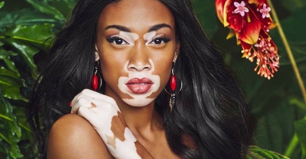 La nueva imagen de Winnie Harlow, la modelo con vitíligo que ha roto todos los estereotipos