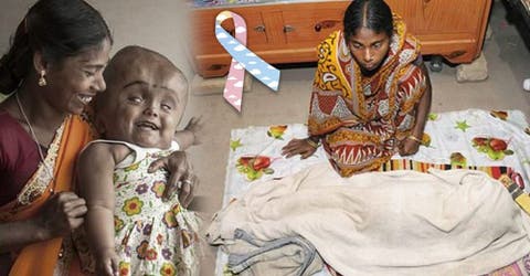 Tras 5 años de lucha, esta pequeña guerrera perdió la batalla contra la hidrocefalia