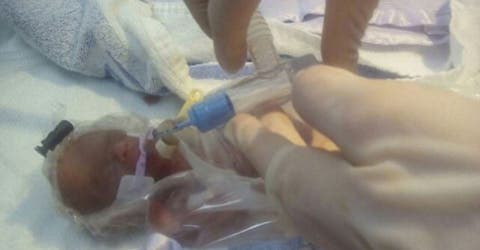 Contra todo pronóstico y pesando 360 gramos, «la bebé milagro» logró sobrevivir