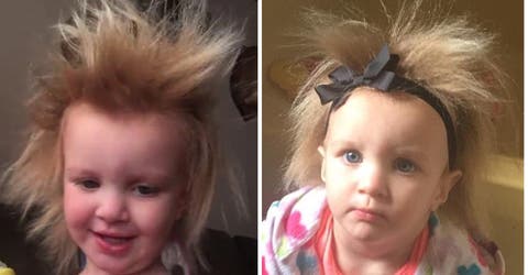Intentan de mil maneras controlar el cabello de su hija pero no hay solución