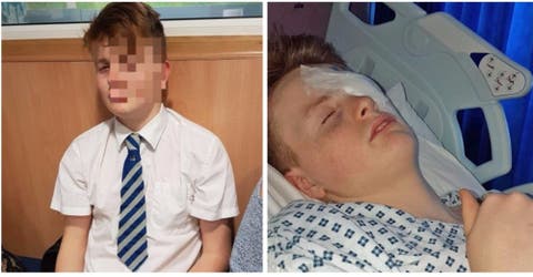 Un joven de 15 años perdió el ojo izquierdo tras la brutal agresión de un compañero de clases