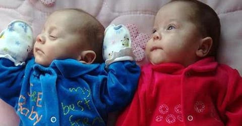Nacen unas gemelas después de pasar 123 días en el vientre de su madre fallecida