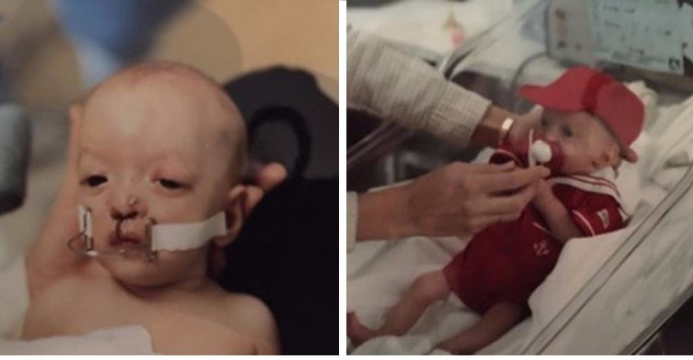 Cuando Dallan nació le pronosticaron 2 años de vida y así celebró su cumpleaños Nº 30 Cuando Dallan nació le pronosticaron 2 años de vida y así celebró su cumpleaños Nº 30