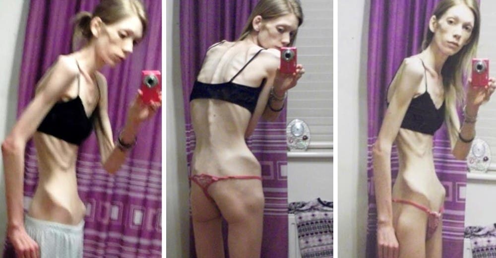 «Escuchaba a los médicos cuando decían que no iba a vivir» – La estremecedora historia de Nicola