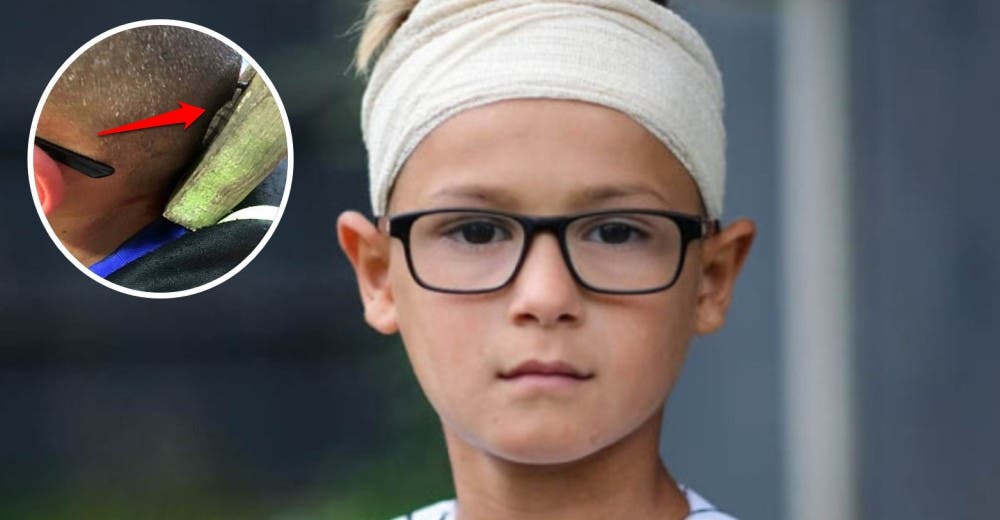 La brutal agresión que sufrió Romeo, un niño autista de 9 años estremece las redes La brutal agresión que sufrió Romeo, un niño autista de 9 años estremece las redes