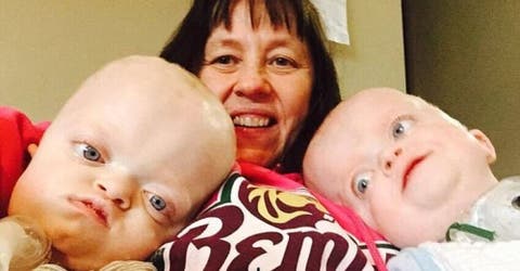 Una enfermera termina adoptando a los gemelos que sus padres no querían por su condición