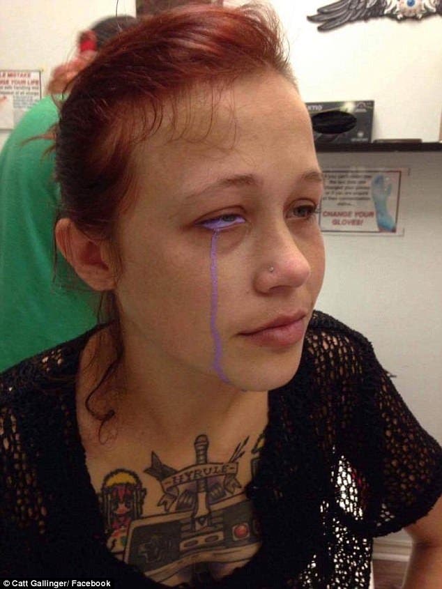 Catt Gallinger canada ottawa tatuaje ojo pierde vista tuerta infección tattoo loses sight sclera esclera parte blanca tinta morada