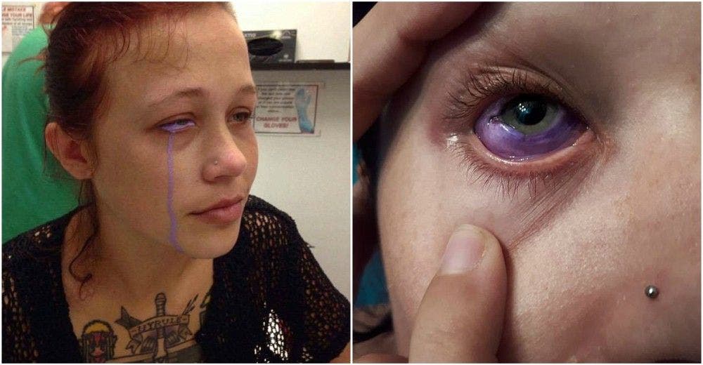 Una modelo de 24 años sufre una pesadilla tras hacerse un tatuaje en un ojo Una modelo de 24 años sufre una pesadilla tras hacerse un tatuaje en un ojo