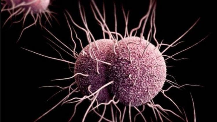 gonorrea enfermedad trasmision sexual imposible tratar resistente antibioticos supervirus mas fuerte 