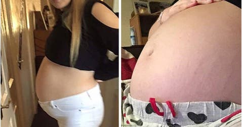 Pensó que su abdomen crecía por su embarazo, pero sufría una enfermedad muy grave