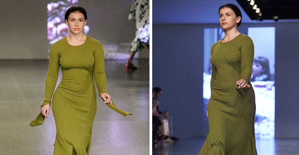 Vicky, una modelo de 22 años que perdió una pierna, pero no las ganas de lograr su sueño Vicky, una modelo de 22 años que perdió una pierna, pero no las ganas de lograr su sueño