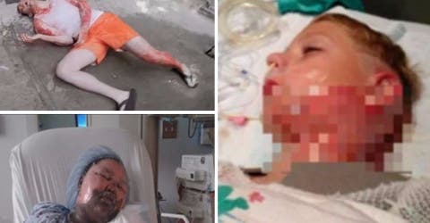 El nuevo reto viral de YouTube está causando muchas quemaduras y muertes