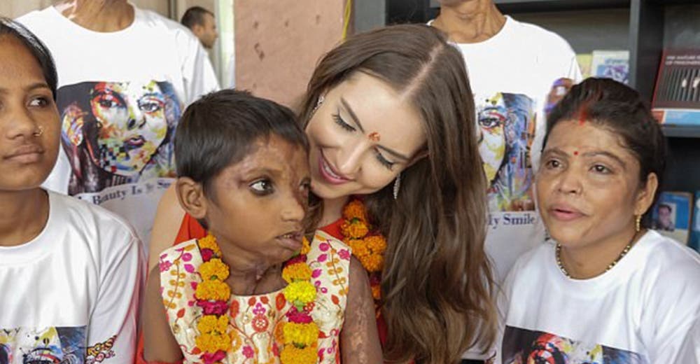El emotivo gesto de una Miss Universo 2017 con Julie, la niña que fue atacada con ácido El emotivo gesto de una Miss Universo 2017 con Julie, la niña que fue atacada con ácido