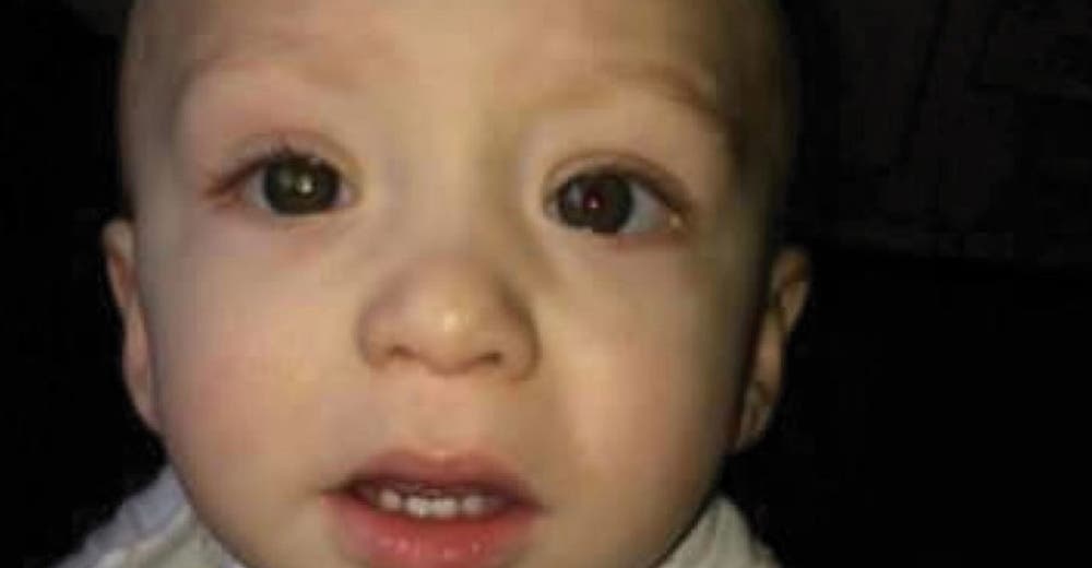 A través de una fotografía que le tomó su papá reconocieron un diagnóstico aterrador A través de una fotografía que le tomó su papá reconocieron un diagnóstico aterrador