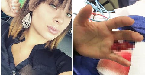 Insólito – La manera en la que esta joven perdió un dedo te pondrá la piel de gallina