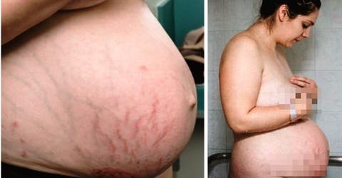 Publicó fotos de su cuerpo después de dar a luz a su tercer hijo para dar un importante mensaje
