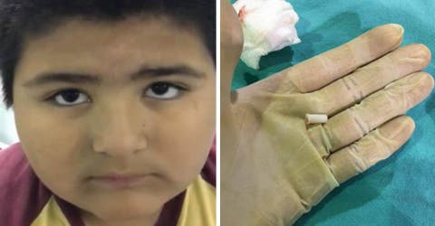 El peligroso accidente de un niño de 8 años causó furor en las redes sociales