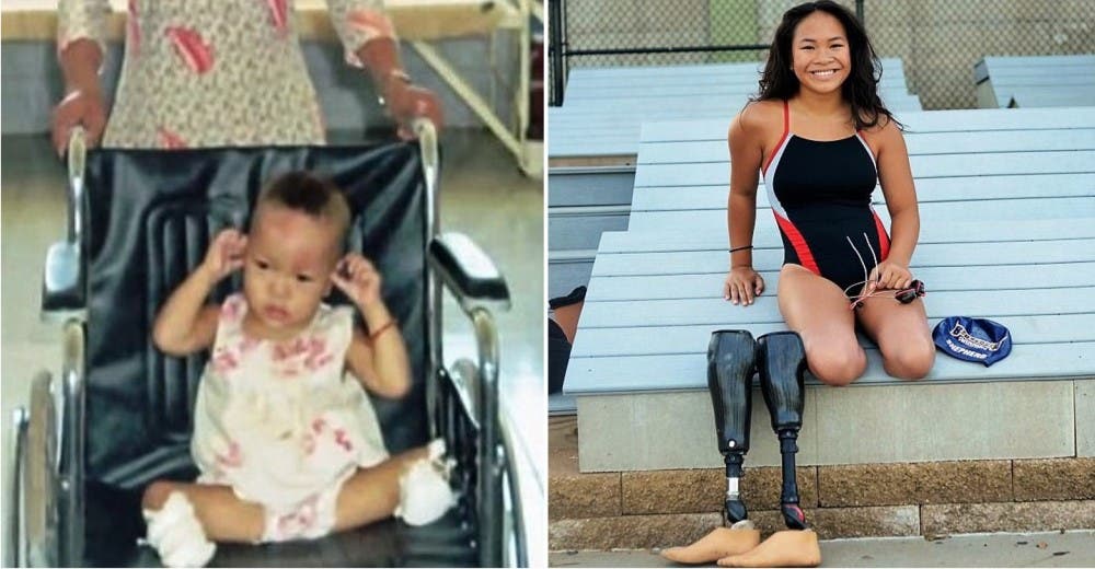 Cuando tenía 20 meses una tragedia la dejó huérfana y sin piernas y ahora cuenta su historia