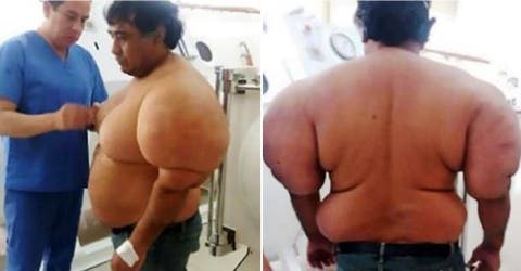 El drama del hombre que salió del mar con 30 kilos más cambiando su vida por completo