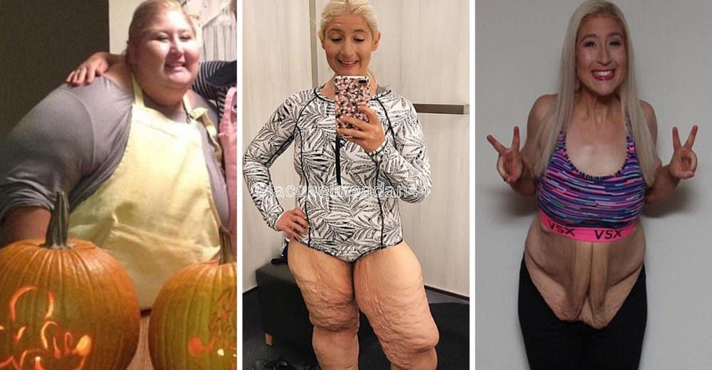 Se atrevió a ir a una piscina tras perder 180 kilos y fue víctima de crueles burlas Se atrevió a ir a una piscina tras perder 180 kilos y fue víctima de crueles burlas