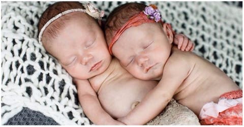 El gesto de estas gemelas al nacer fue tan impactante que hasta los médicos quedaron perplejos
