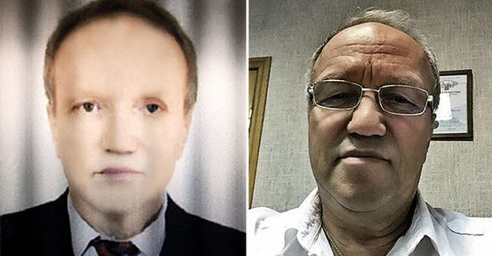 Un hombre ruso está sufriendo un insólito cambio en su piel tras recibir un trasplante de hígado Un hombre ruso está sufriendo un insólito cambio en su piel tras recibir un trasplante de hígado